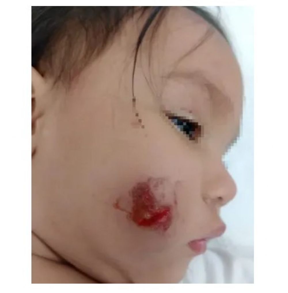 Una patota atacó una casa e hirió a una bebé